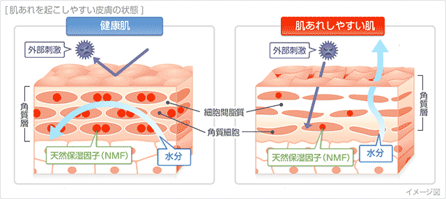 肌荒れを起こしやすい皮膚の状態